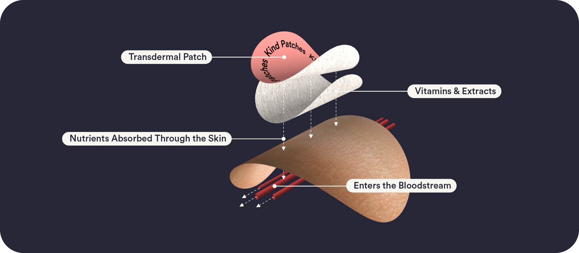 How transdermal patches work